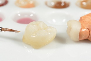 Dental crowns during crafting process