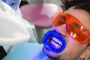 patient undergoing teeth whitening in Arcadia