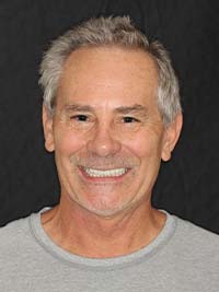 Man's smile after dental treatment