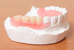 Model smile with partial dentures