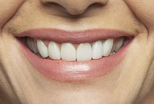 Closeup of healthy beautiful smile