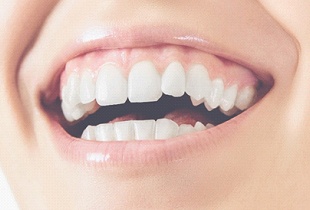 Teeth and gums