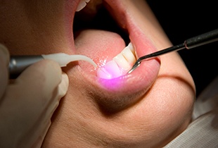 Patient receiving laser dentistry treatment