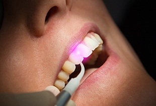 Patient receiving hard tissue laser treatment