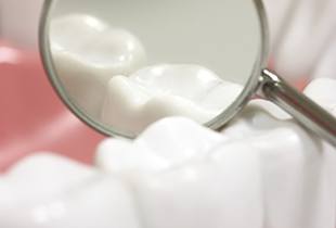 Closeup of tooth during dental exam