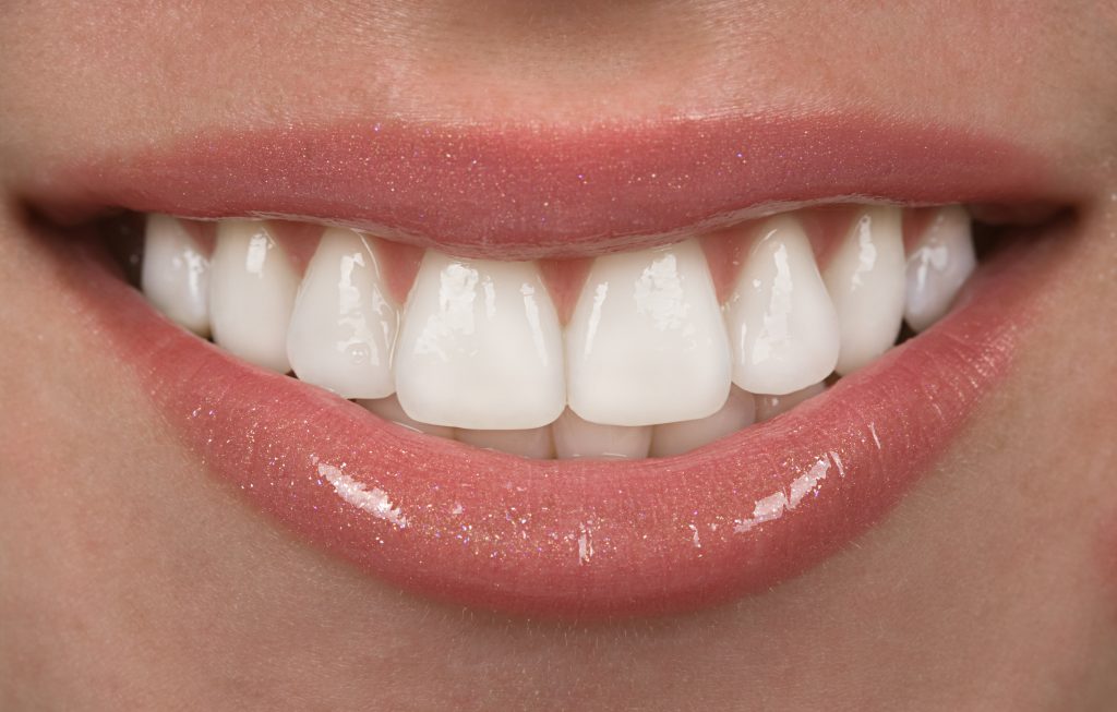 Woman smiling with perfect teeth