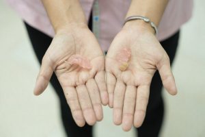 a person holding their broken denture in two hands