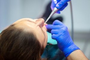 a woman sedated for a dental procedure