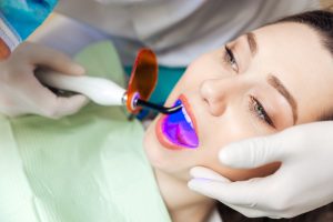 Woman laser bleaching teeth