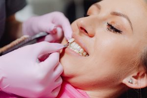 Woman having consultation for veneers